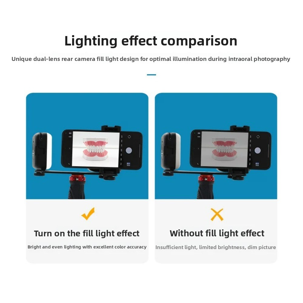 치과 사진 촬영 조명, 스마트폰용 블루투스 LED 플래 - Lighting Gallery 리뷰 및 가격